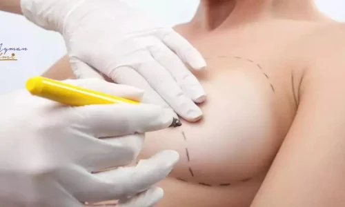 مين جربت ابر تكبير الثدي؟
