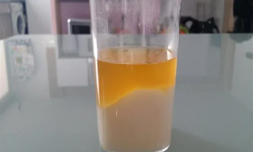 من جربت تحليل الملح وطلعت حامل؟