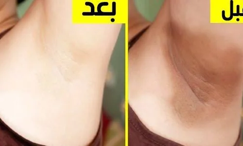 تجربتي في تبييض الابط