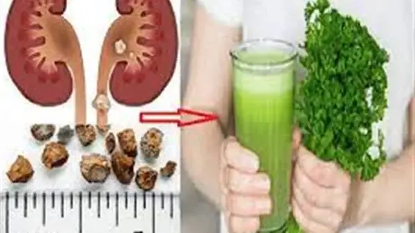 ما هي فوائد مغلي البقدونس؟