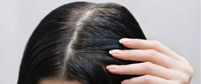 تجربتي في علاج الشيب المبكر