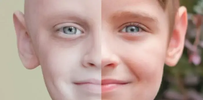 السرطان في المنام للمتزوجة