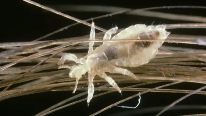 القمل في منام المطلقه