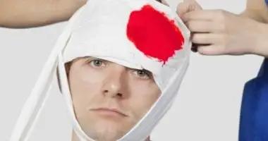 تفسير حلم شخص يضربني على رأسي