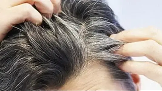 الشعر الابيض في المنام للمتزوجة