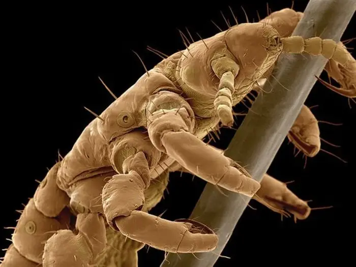 تفسير حلم القمل ابن سيرين